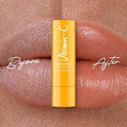 Vitamin C🍋 Lip Therapy with SPF 50☀️